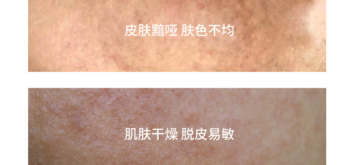 Ԋ(sh��)���r����?z��)��ɾ��AҺ