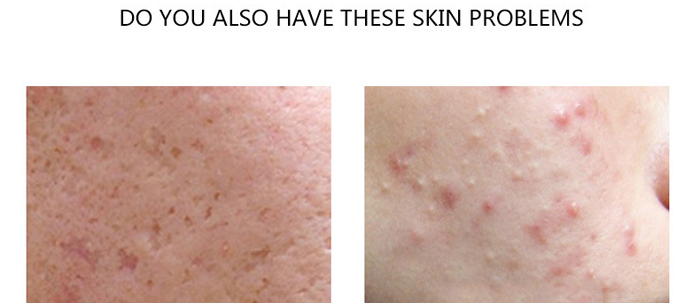 ���B(y��ng)���������o��